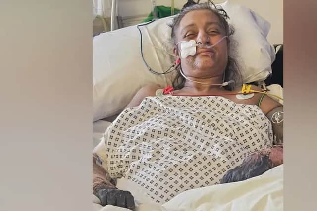 Manjit Sangha was in hospital for 32 weeks due to her illness. Photo: Kam Sangha