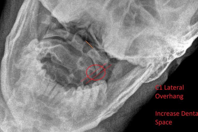 An X-Ray of Connor Edward's skull shows a lateral overhang