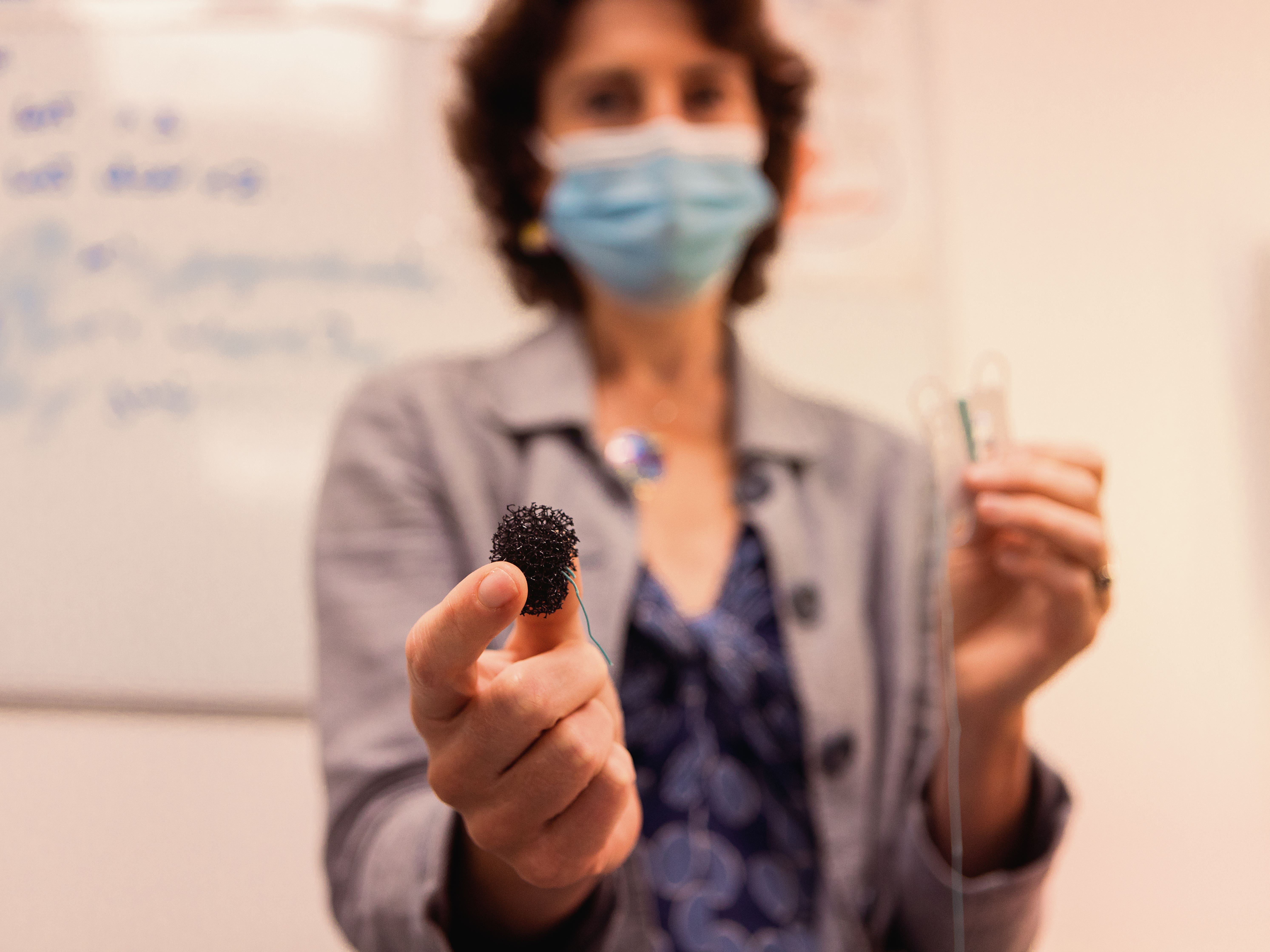 Major trial of sponge test aims to prevent oesophageal cancer deaths