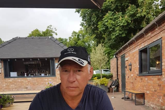 Michael Taylor's life has changed dramatically since receiving the stem cell treatment.