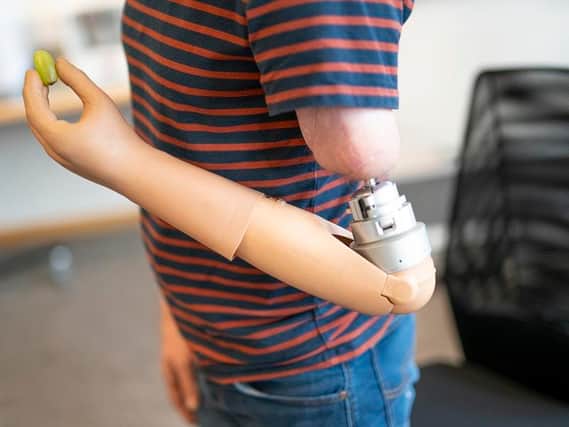 Heavy Bionic Arm Self-contained bionic arm controlled by mind ‘could be available in two ...