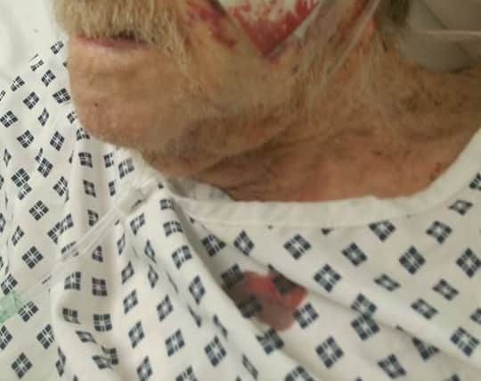 Arthur Gumbley pictured in hospital after he was beaten