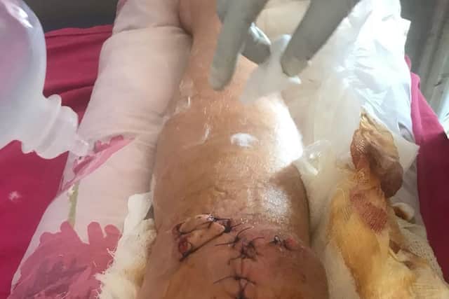 His injured knee after the accident 