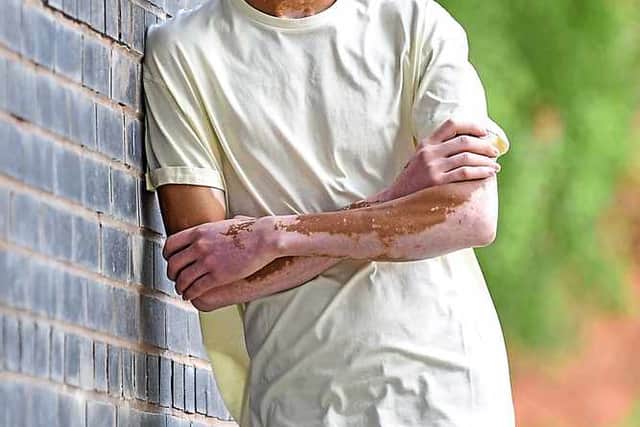 Nile Goodlad, aged 20, from Walsall, has signed to a modelling agency