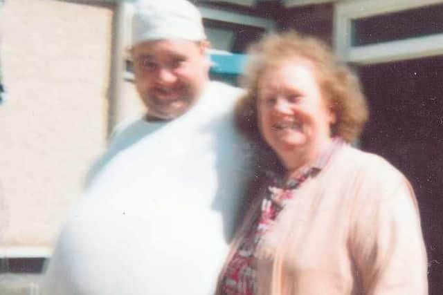 Rob before the weightloss