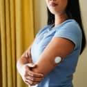 An insulin patch on the arm of a young woman with her arms folded
