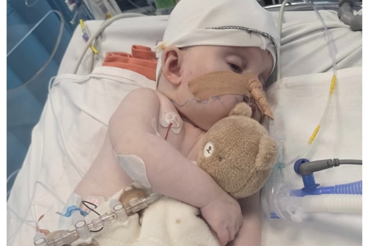Fundraiser launched as Staffordshire baby diagnosed with very rare brain ...