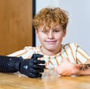 Fin Lawlor has received his new bionic arm in time for school