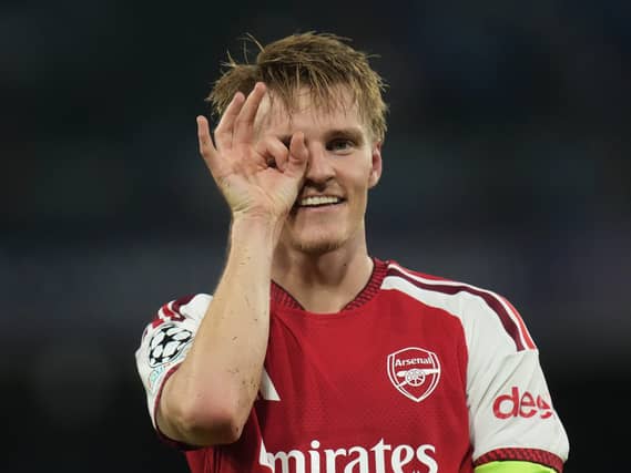 Arsenal's Martin Odegaard holds his fingers in front of his eye