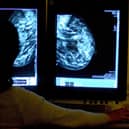 Person seen from behind looking at breast screening images