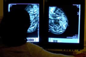 Person seen from behind looking at breast screening images