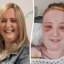Mum's headaches put down to migraines six times by GP were tennis ball-sized tumour