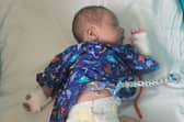 Jahsiah Taylor-Johnson, who has undergone chemotherapy for a tumour on his eye