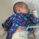 Jahsiah Taylor-Johnson, who has undergone chemotherapy for a tumour on his eye