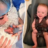 Baby Samson was diagnosed with spina bifida myelomeningocele