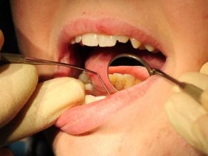 Dentist crisis