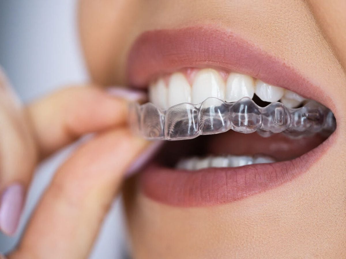 Clear Aligner Dental Night Guard For Teeth