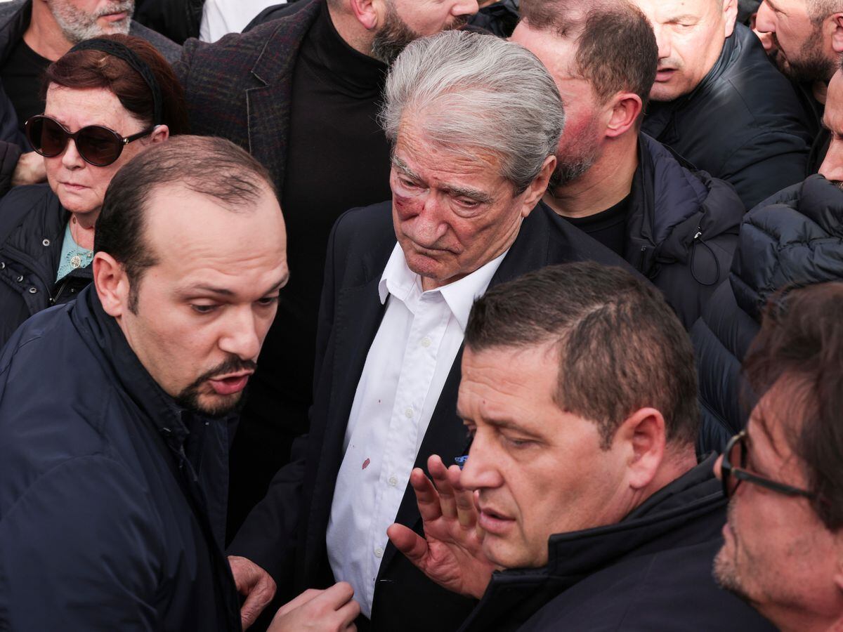 Albanian opposition leader attacked during anti-government protest ...