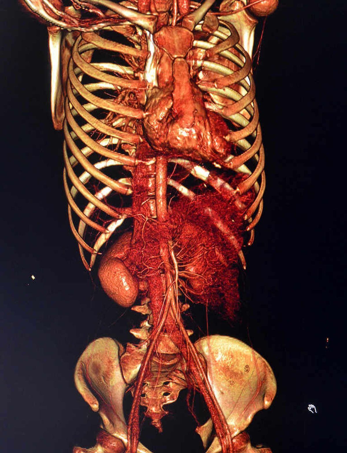 A 3D scan of a body using the technology at the £1.2m autopsy centre