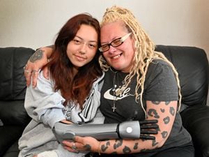 Keeley Bexton, from Wolverhampton, has raised £13,000 to fund a bionic arm for herself after being born without the lower part of her arm. She is pictured with mum Michelle