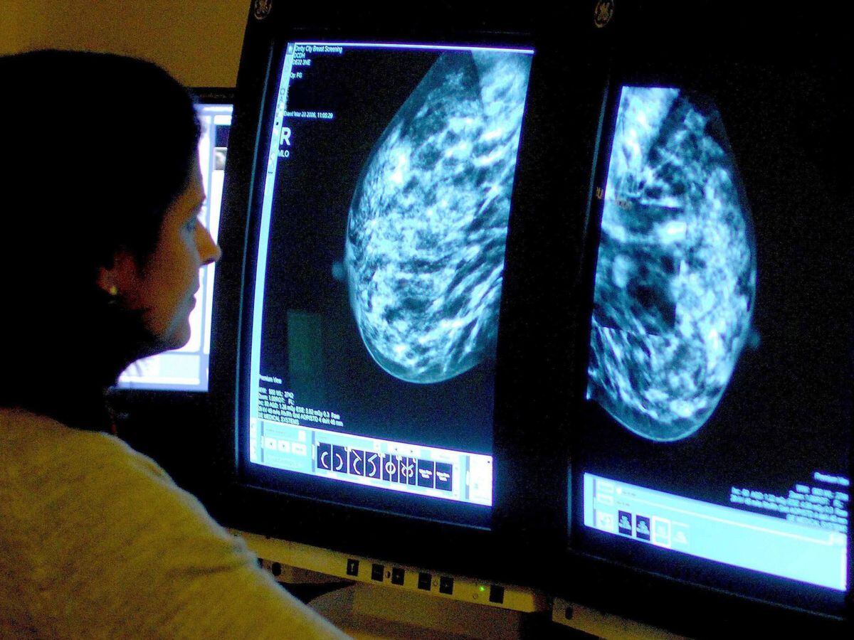 Breast scan studied