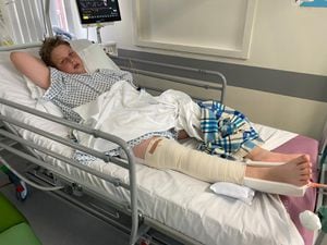 Jake Morristhen aged 14, suffered a badly broken leg