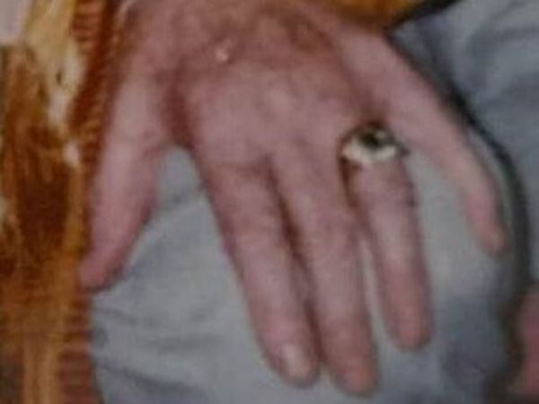 Staffordshire Police are asking for help with finding this wedding ring. Photo: Staffordshire Police