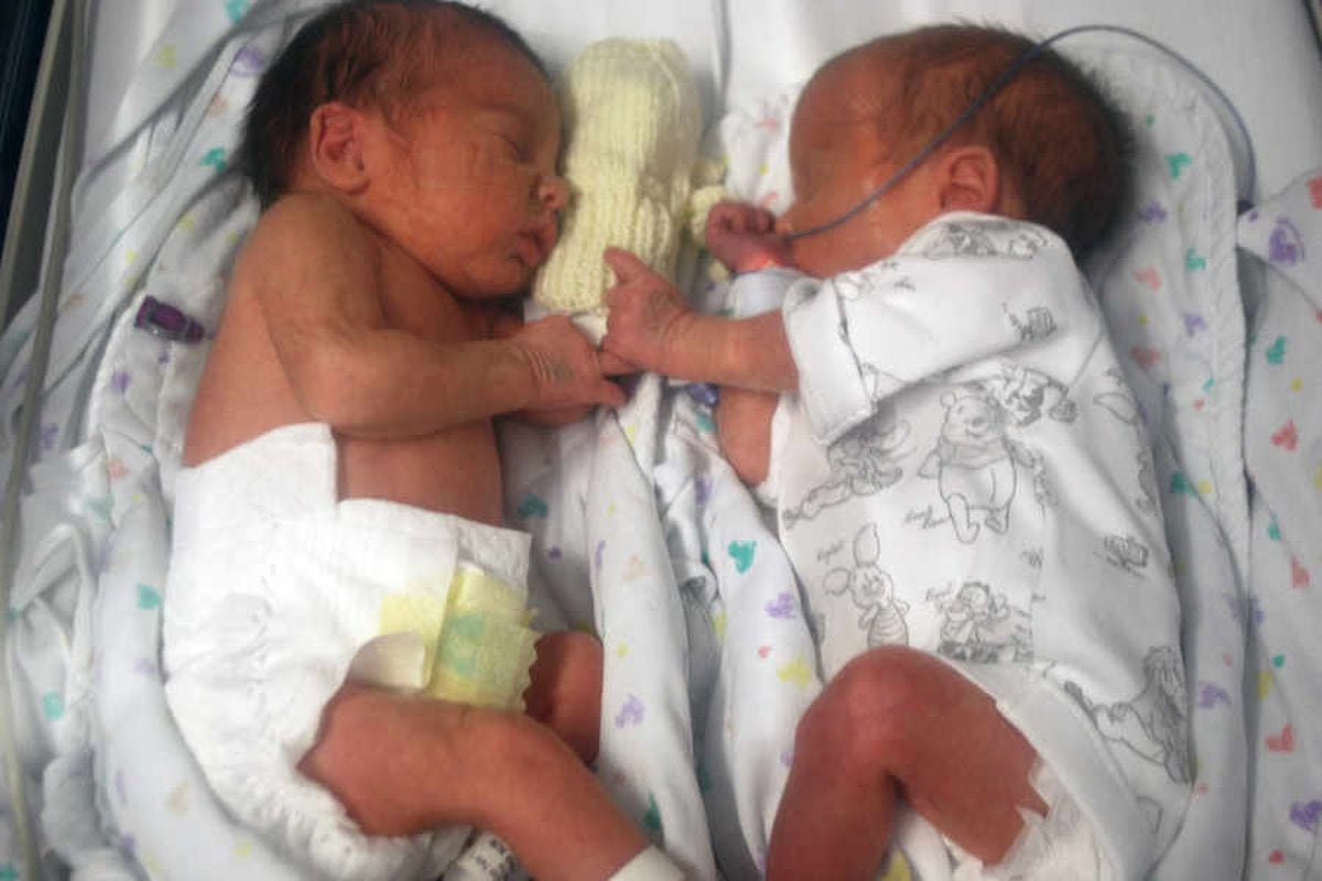 The twins in hospital soon after they were born