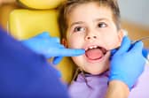  Children's tooth decay worse than national average in Sandwell and Walsall, and fewer children see an NHS dentist
