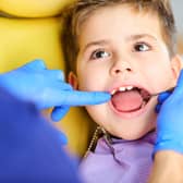  Children's tooth decay worse than national average in Sandwell and Walsall, and fewer children see an NHS dentist
